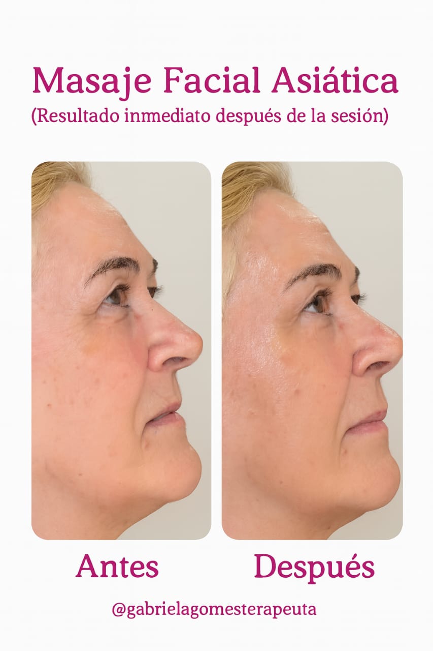 Masajeador Antiarrugas Y Rodillo